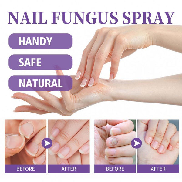 Spray Regenerator pentru Unghii